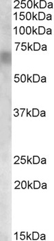 PC Antibody