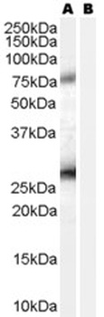 PTCH Antibody