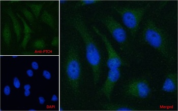 PTCH1 Antibody