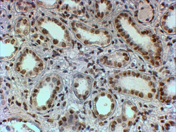 PTB Antibody