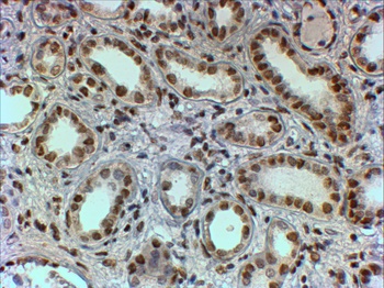 PTBP1 Antibody