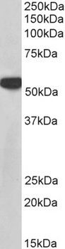 PTB Antibody
