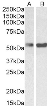 PTB Antibody
