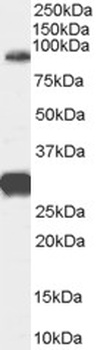 PRPF31 Antibody