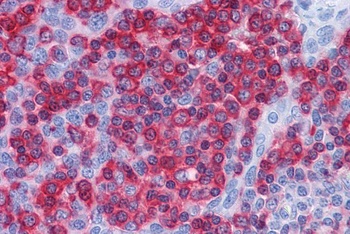 PREP Antibody
