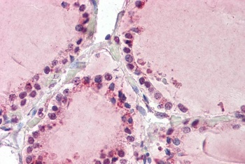 Proenkephalin Antibody