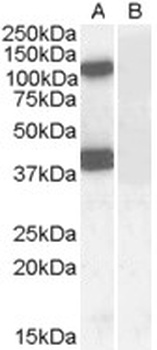 Proenkephalin Antibody