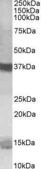 PFDN1 Antibody