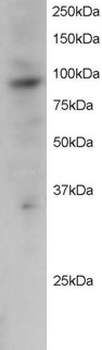 PRAM1 Antibody