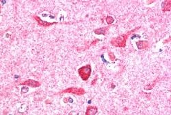 PITPNM3 Antibody