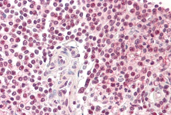 Pirin Antibody