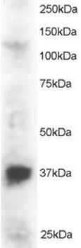 PINX1 Antibody