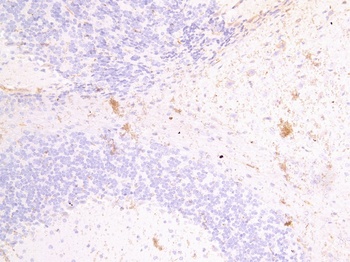 PINK1 Antibody