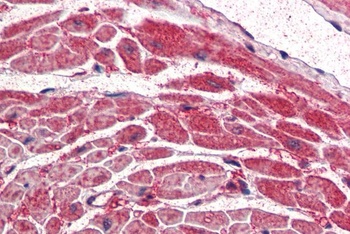 PIK3CA Antibody