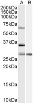 PIK3CA Antibody