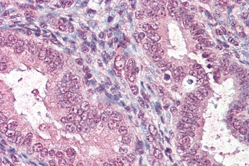 PIAS2 Antibody