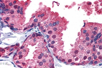 PDE4B Antibody