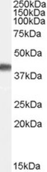 PHLPPL Antibody