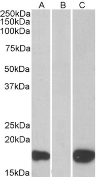 PHLDA3 Antibody