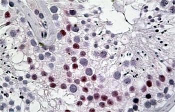 LSP1 Antibody