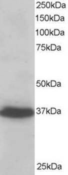 PDLIM4 Antibody