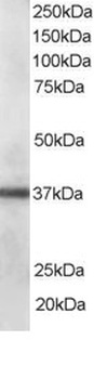 PDLIM1 Antibody