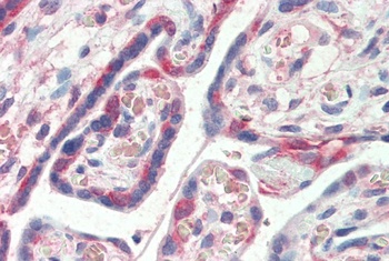 PDLIM1 Antibody