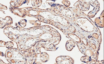 PD-L1 Antibody