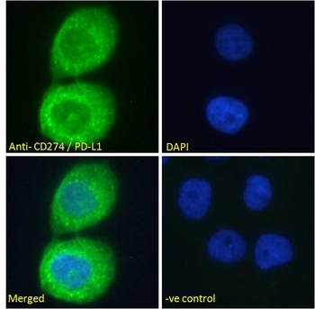 PD-L1 Antibody