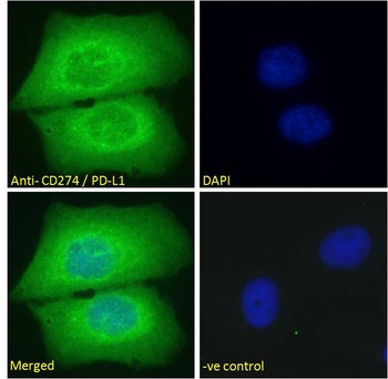 PD-L1 Antibody