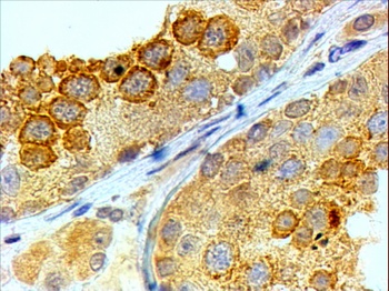 PD-L1 Antibody