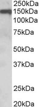 PDE4D Antibody