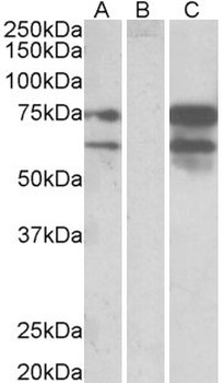 PDE11A Antibody