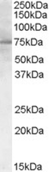 PCSK9 Antibody