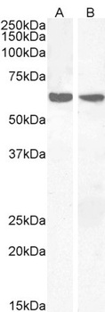 PCSK9 Antibody