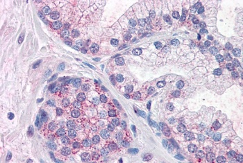 PAX6 Antibody
