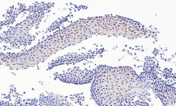PAX3 Antibody
