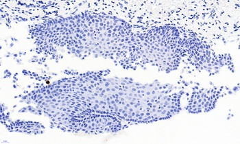 PAX3 Antibody