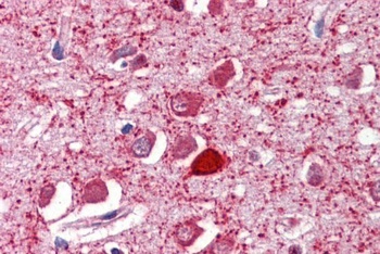 Parvalbumin Antibody