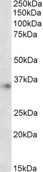 Parvalbumin Antibody