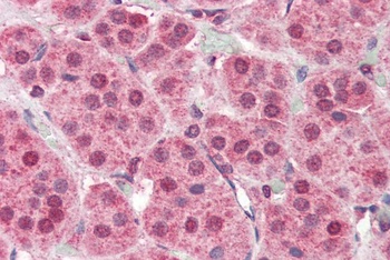 PARP2 Antibody