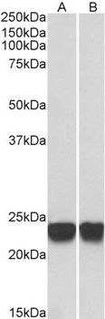 PARK7 Antibody