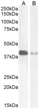 PAR6 alpha Antibody