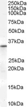 PAK1 Antibody