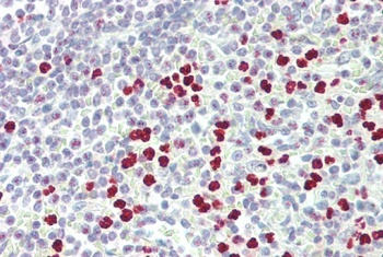 PADI4 Antibody