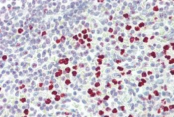 PAD4 Antibody