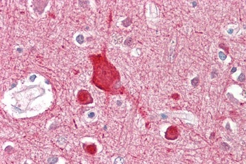 OX1 Receptor Antibody