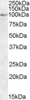 OSBP Antibody