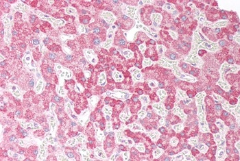 ORP5 Antibody