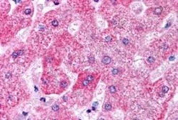 ORP5 Antibody